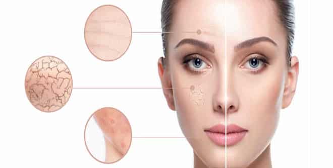 The effect of salicylic acid on dry skin