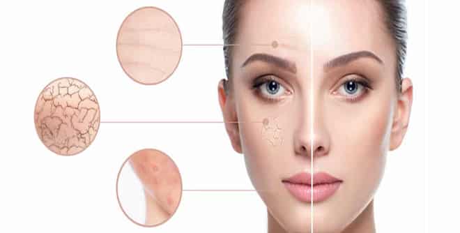  The effect of salicylic acid on dry skin